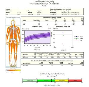 DEXA Scan Sample